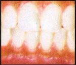 Healthy Mouth